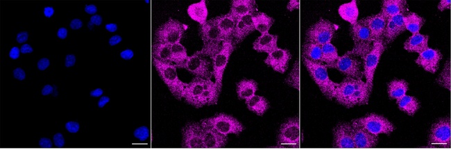 C17orf58 Antibody in Immunocytochemistry (ICC/IF)