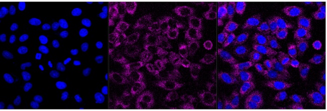 BTF3 Antibody in Immunocytochemistry (ICC/IF)
