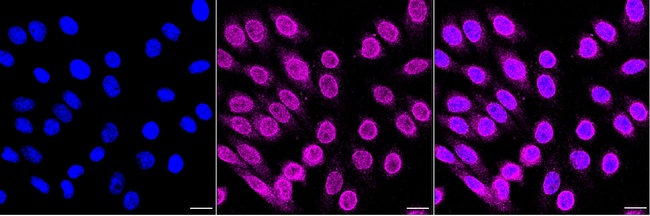 BST-2 Antibody in Immunocytochemistry (ICC/IF)