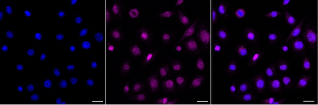 BNIP3 Antibody in Immunocytochemistry (ICC/IF)