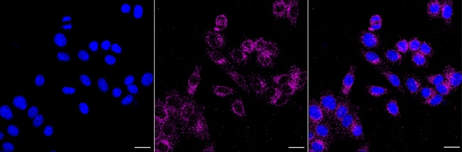 Bim Antibody in Immunocytochemistry (ICC/IF)