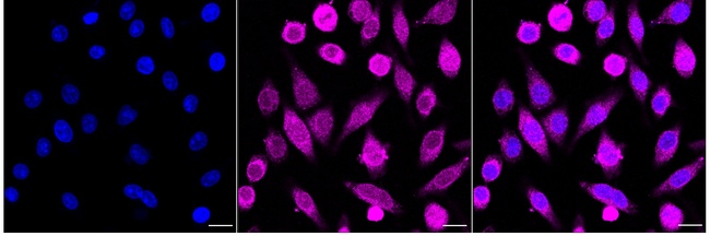 Bcl-10 Antibody in Immunocytochemistry (ICC/IF)