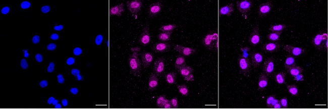 ATM Antibody in Immunocytochemistry (ICC/IF)