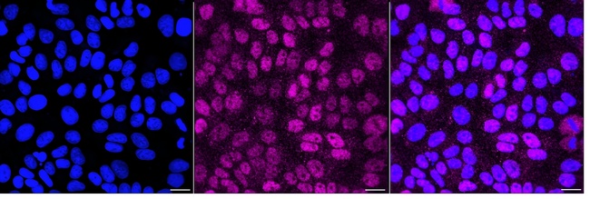 ATM Antibody in Immunocytochemistry (ICC/IF)