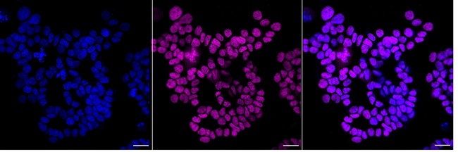 AP2 gamma Antibody in Immunocytochemistry (ICC/IF)