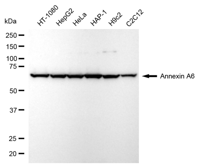 Annexin A6 Antibody in Western Blot (WB)