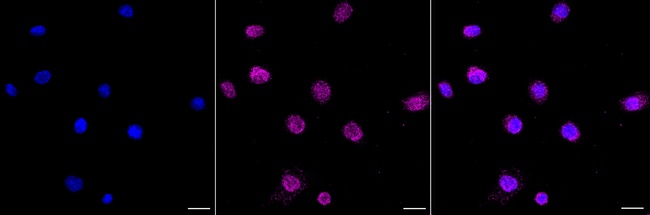 Annexin A6 Antibody in Immunocytochemistry (ICC/IF)