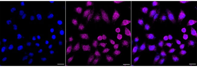 Aminoacylase Antibody in Immunocytochemistry (ICC/IF)