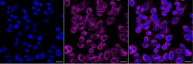 ALG2 Antibody in Immunocytochemistry (ICC/IF)