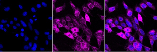 Aladin Antibody in Immunocytochemistry (ICC/IF)