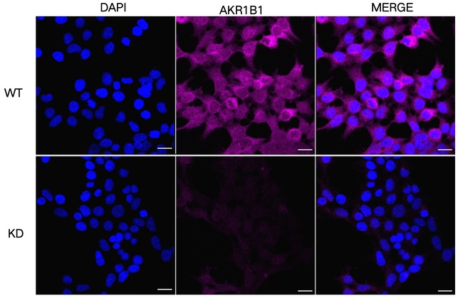 AKR1B1 Antibody in Immunocytochemistry (ICC/IF)