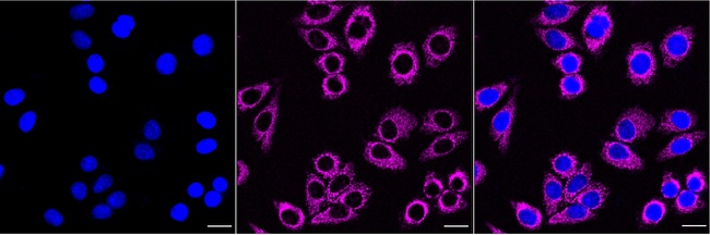 AIF Antibody in Immunocytochemistry (ICC/IF)