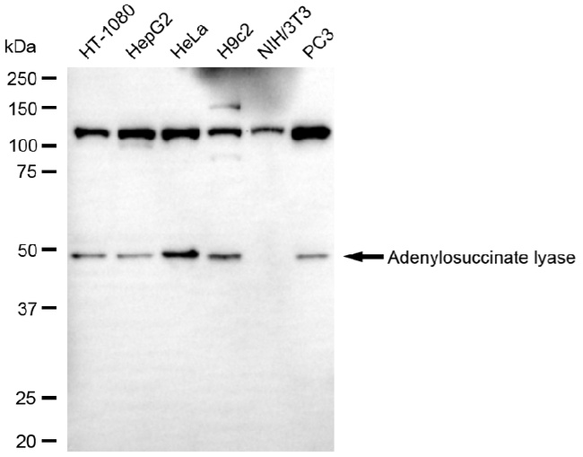 ADSL Antibody in Western Blot (WB)