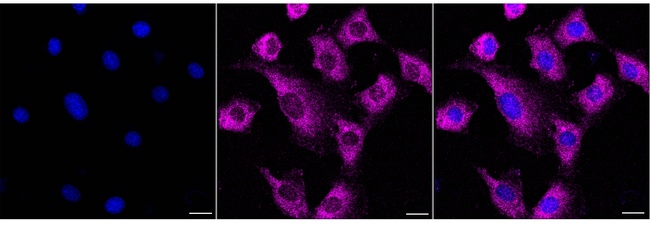 Adenylate Kinase 3 Antibody in Immunocytochemistry (ICC/IF)