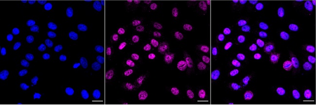 ADAR1 Antibody in Immunocytochemistry (ICC/IF)