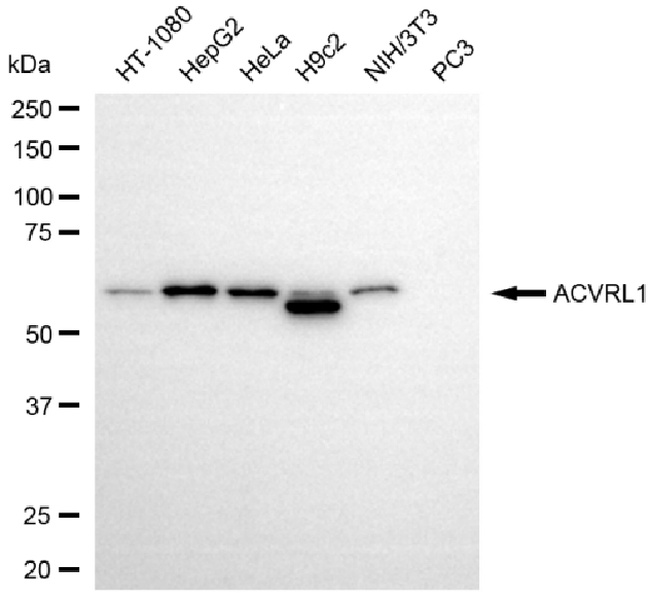 ACVRL1 Antibody in Western Blot (WB)