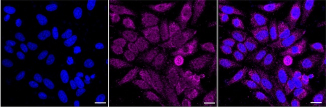 Aconitase 2 Antibody in Immunocytochemistry (ICC/IF)
