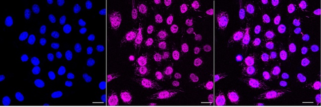 p53 Antibody in Immunocytochemistry (ICC/IF)