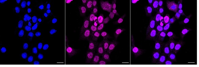 p53 Antibody in Immunocytochemistry (ICC/IF)