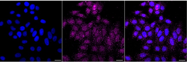 ACADM Antibody in Immunocytochemistry (ICC/IF)