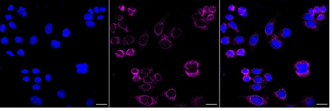 ACADM Antibody in Immunocytochemistry (ICC/IF)