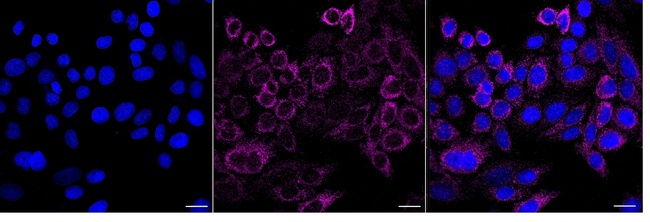 ACAD9 Antibody in Immunocytochemistry (ICC/IF)