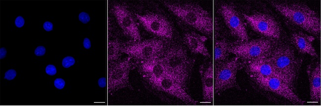 ABCF2 Antibody in Immunocytochemistry (ICC/IF)