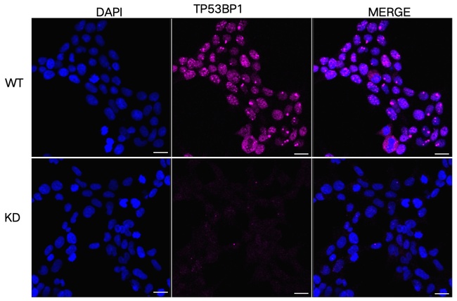 53BP1 Antibody in Immunocytochemistry (ICC/IF)