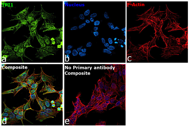 TPI1 Antibody in Immunocytochemistry (ICC/IF)