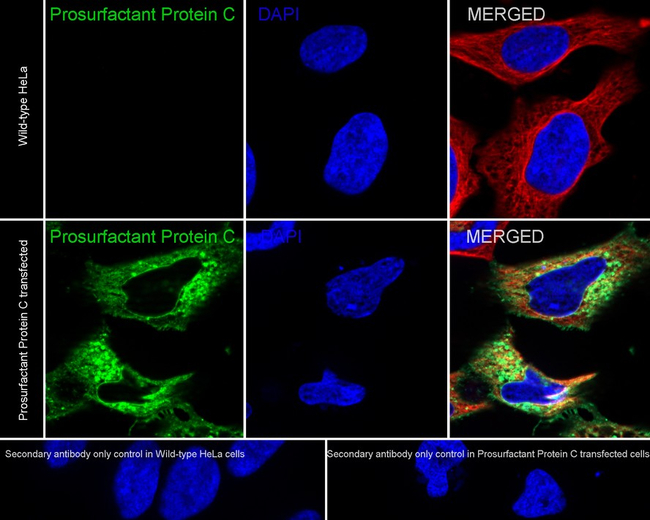 SFTPC Antibody in Immunocytochemistry (ICC/IF)