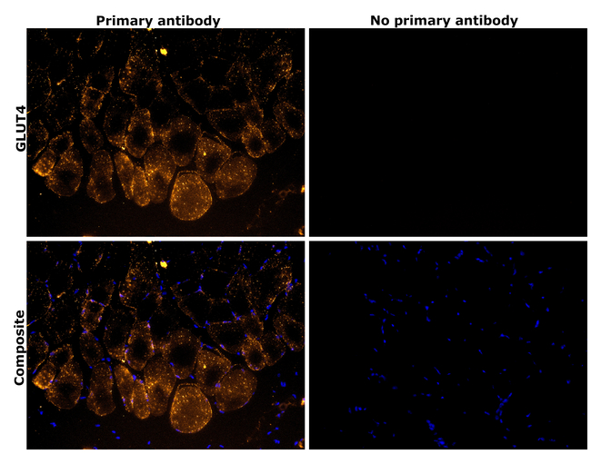 GLUT4 Antibody in Immunohistochemistry (Paraffin) (IHC (P))