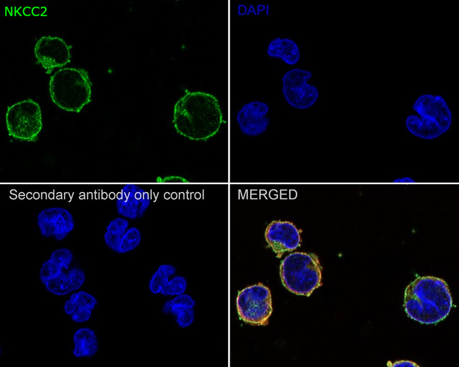 NKCC2 Antibody in Immunocytochemistry (ICC/IF)
