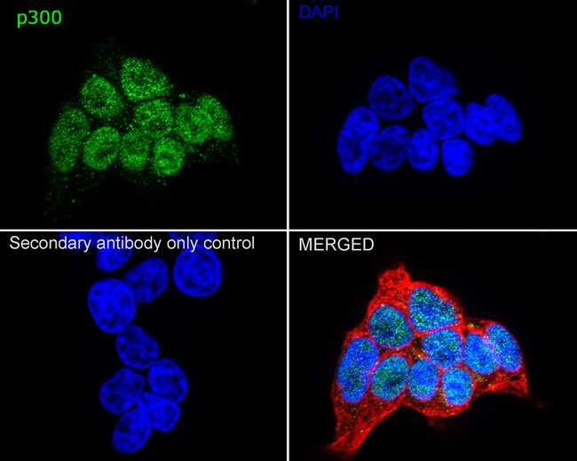 p300 Antibody in Immunocytochemistry (ICC/IF)