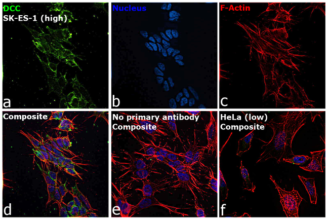 DCC Antibody in Immunocytochemistry (ICC/IF)