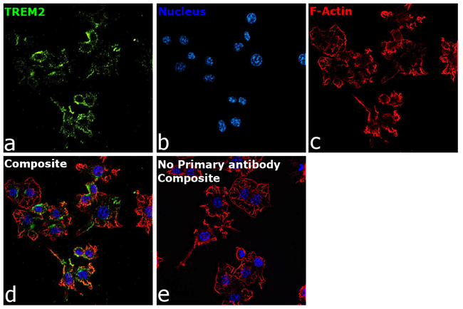 TREM2 Antibody in Immunocytochemistry (ICC/IF)