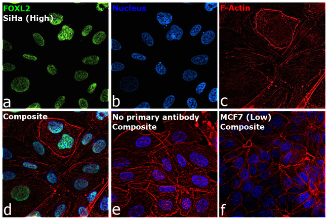 FOXL2 Antibody in Immunocytochemistry (ICC/IF)