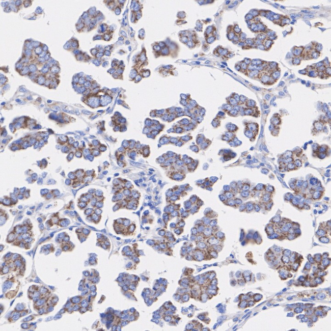 CIP2A Antibody in Immunohistochemistry (Paraffin) (IHC (P))