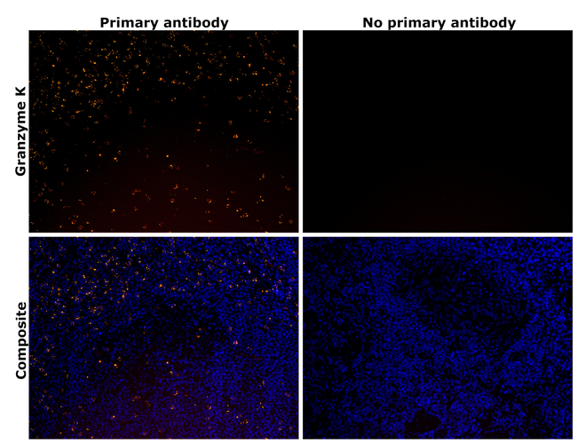 Granzyme K Antibody in Immunohistochemistry (Paraffin) (IHC (P))