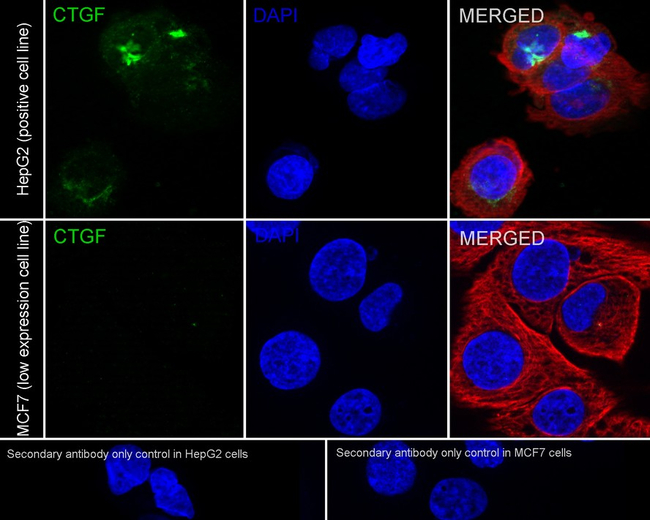 CTGF Antibody in Immunocytochemistry (ICC/IF)