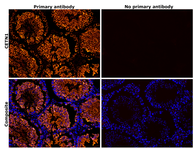 Centrin 1 Antibody in Immunohistochemistry (Paraffin) (IHC (P))