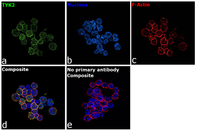 TYK2 Antibody in Immunocytochemistry (ICC/IF)