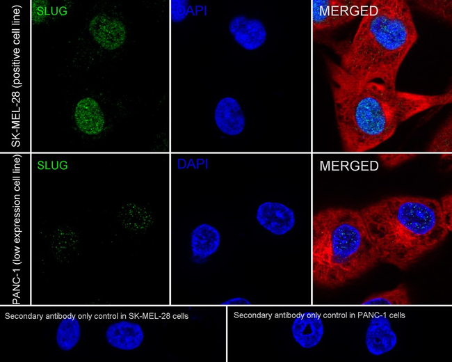 SLUG Antibody in Immunocytochemistry (ICC/IF)