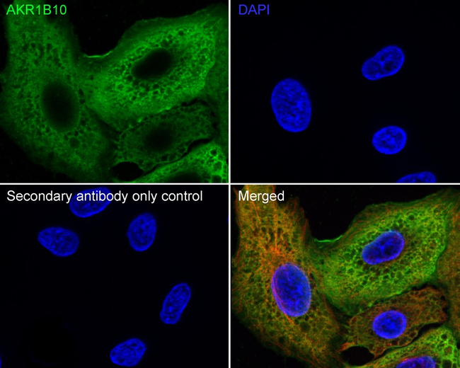 AKR1B10 Antibody in Immunocytochemistry (ICC/IF)