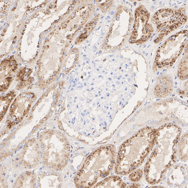 Cathepsin C  Antibody in Immunohistochemistry (Paraffin) (IHC (P))