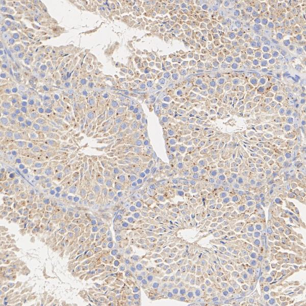 TMEM106B Antibody in Immunohistochemistry (Paraffin) (IHC (P))