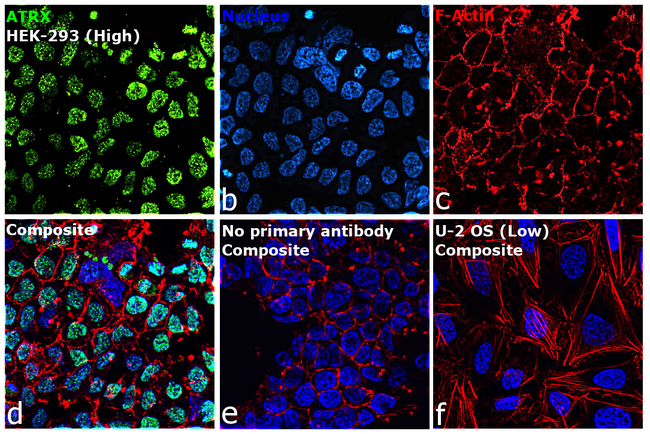 ATRX Antibody in Immunocytochemistry (ICC/IF)