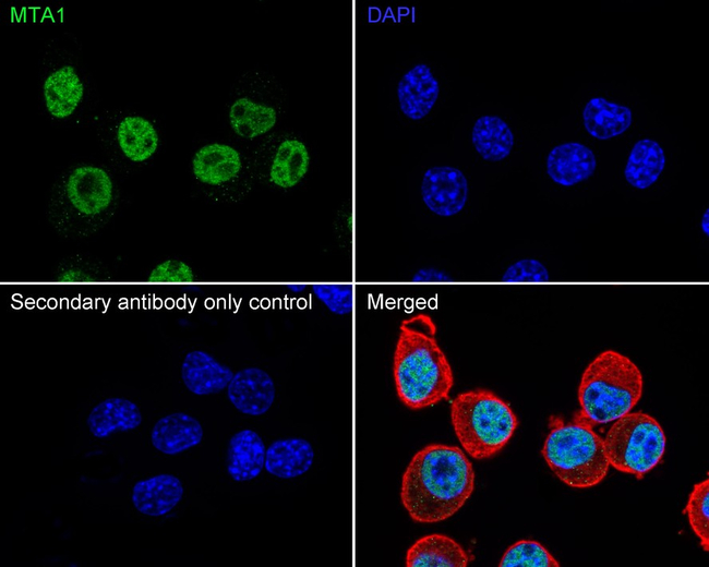 MTA1 Antibody in Immunocytochemistry (ICC/IF)