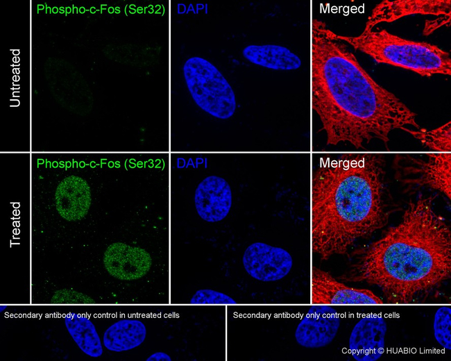 Phospho-c-Fos (Ser32) Antibody in Immunocytochemistry (ICC/IF)