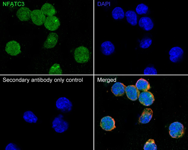 NFATC3 Antibody in Immunocytochemistry (ICC/IF)