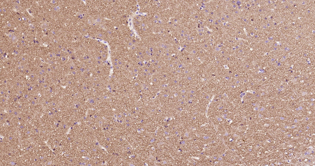 alpha Synuclein Antibody in Immunohistochemistry (Paraffin) (IHC (P))